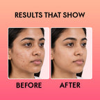 Watermelon Face Gel with Niacinamide & Hyaluronic Acid