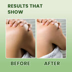 Tea Tree BODYWASH | Acne Control • Deep Cleansing • Oil Balancing