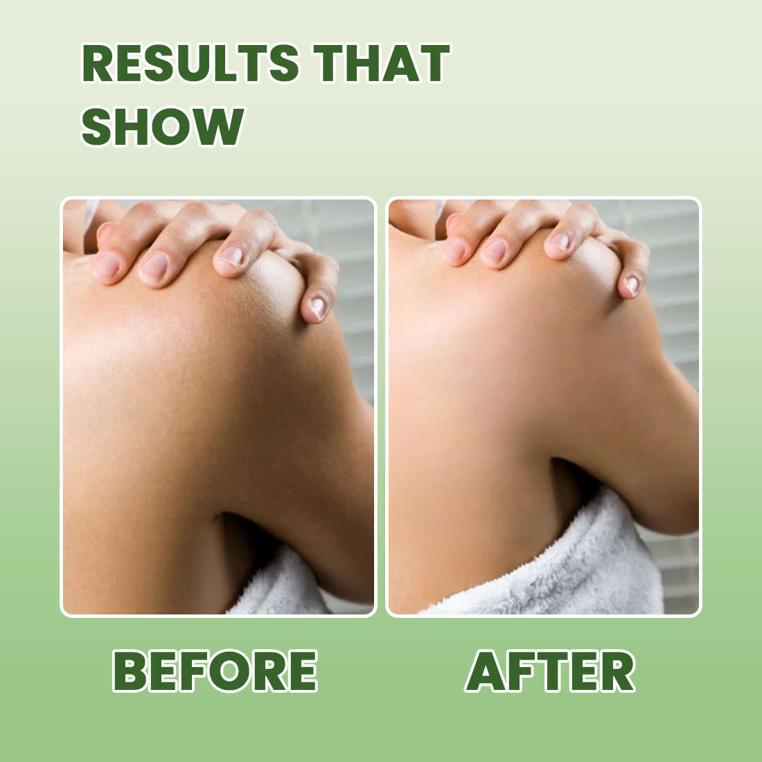 Tea Tree BODYWASH | Acne Control • Deep Cleansing • Oil Balancing