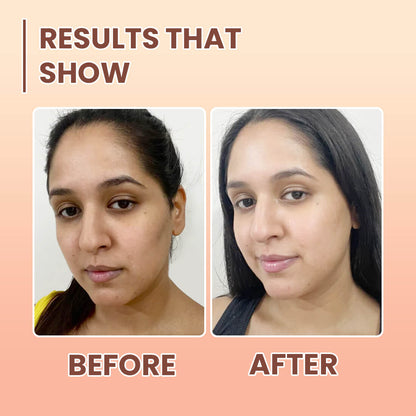 Antioxidant E Face Serum with Niacinamide & Hyaluronic Acid