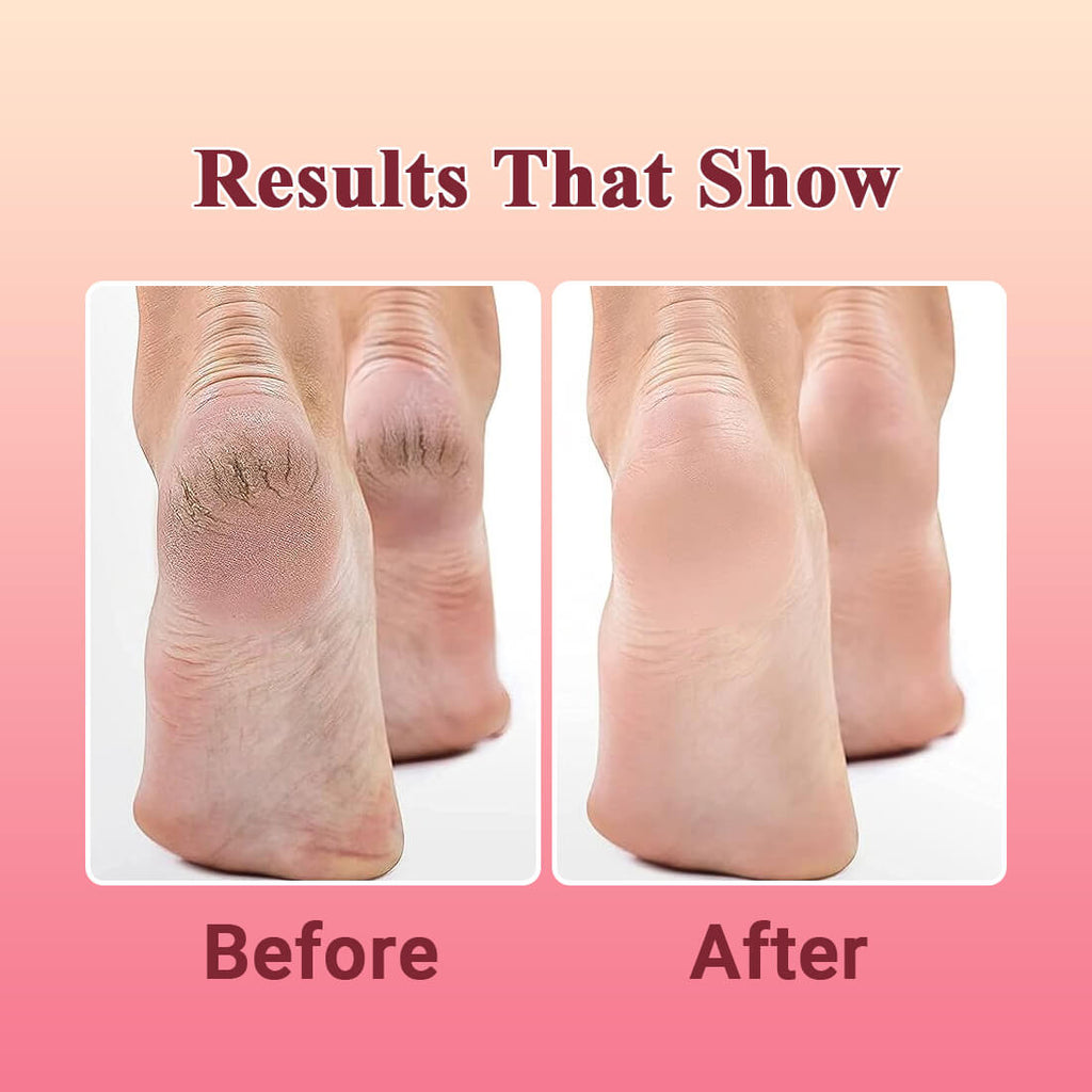Hand & Foot Cream | Moisturizing & Healing