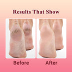 Hand & Foot Cream | Moisturizing & Healing