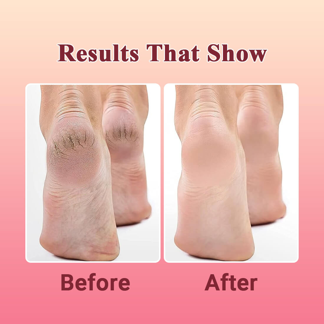 Hand & Foot Cream | Moisturizing & Healing